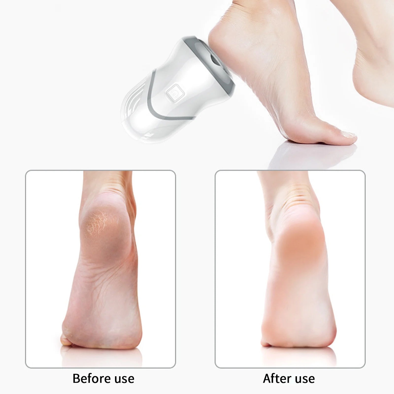Electric Feet Callus Remover,Portable Rechargeable Foot File Pedicure Tools,Ideal for Dead Skin,Two Gears of Adjustment, Does Not Hurt the Skin